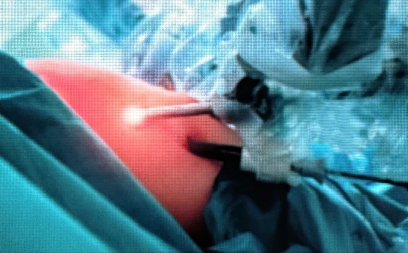 Sesto - Un intero pomeriggio per accendere i riflettori sul tema dell'obesità, sui percorsi di cura, ma soprattutto sulla prevenzione.